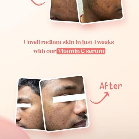 Vitamin c testimonial