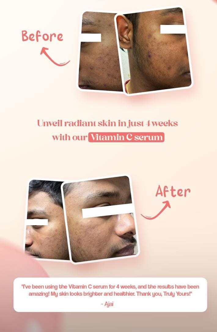 Vitamin c testimonial