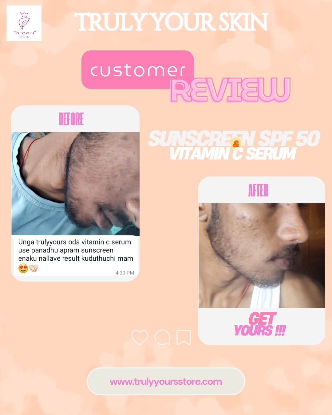 Sunscreen SPF 50 (50GM)